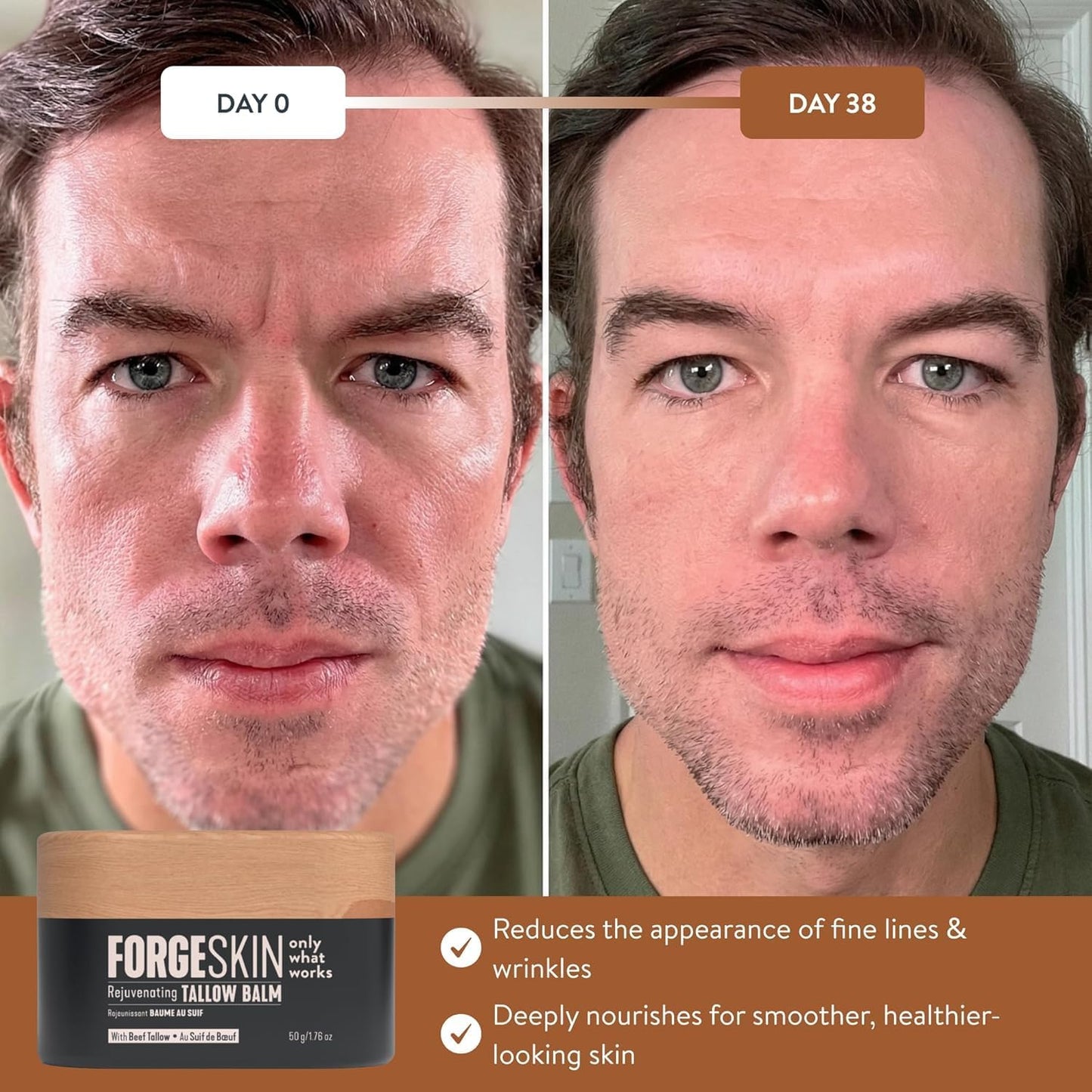 Forge Skin Beef Tallow Balm Moisturizer for Men Skin Care - Face + Body Wrinkle Defense, Hydration Cream - Natural Skincare Lotion (1.7 OZ)